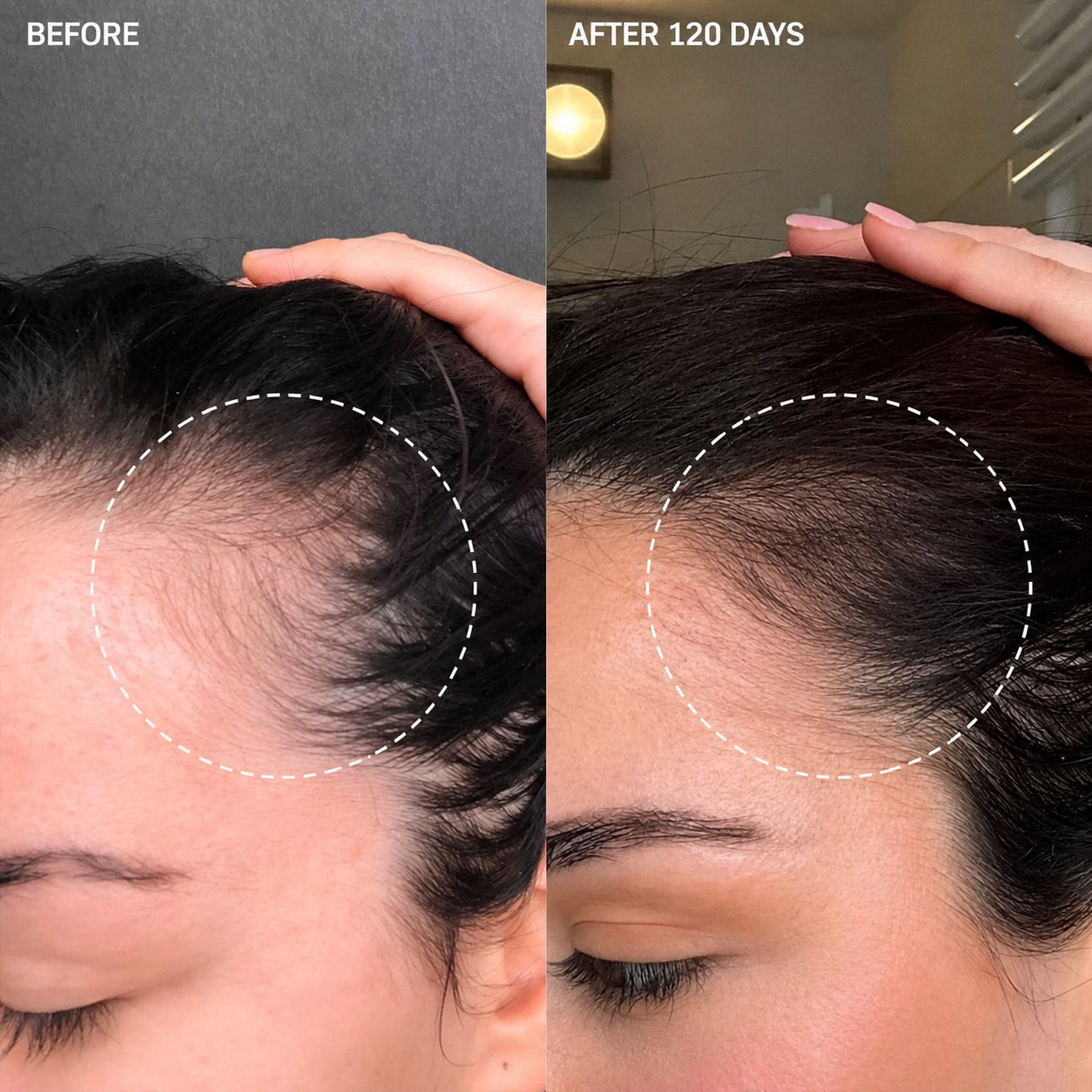 Hair shedding results