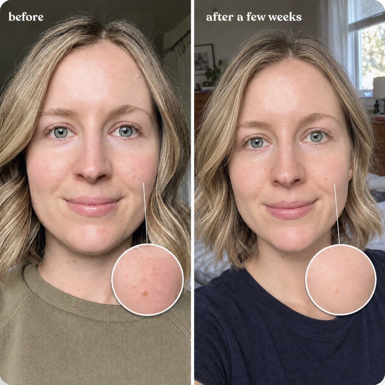 Redness results