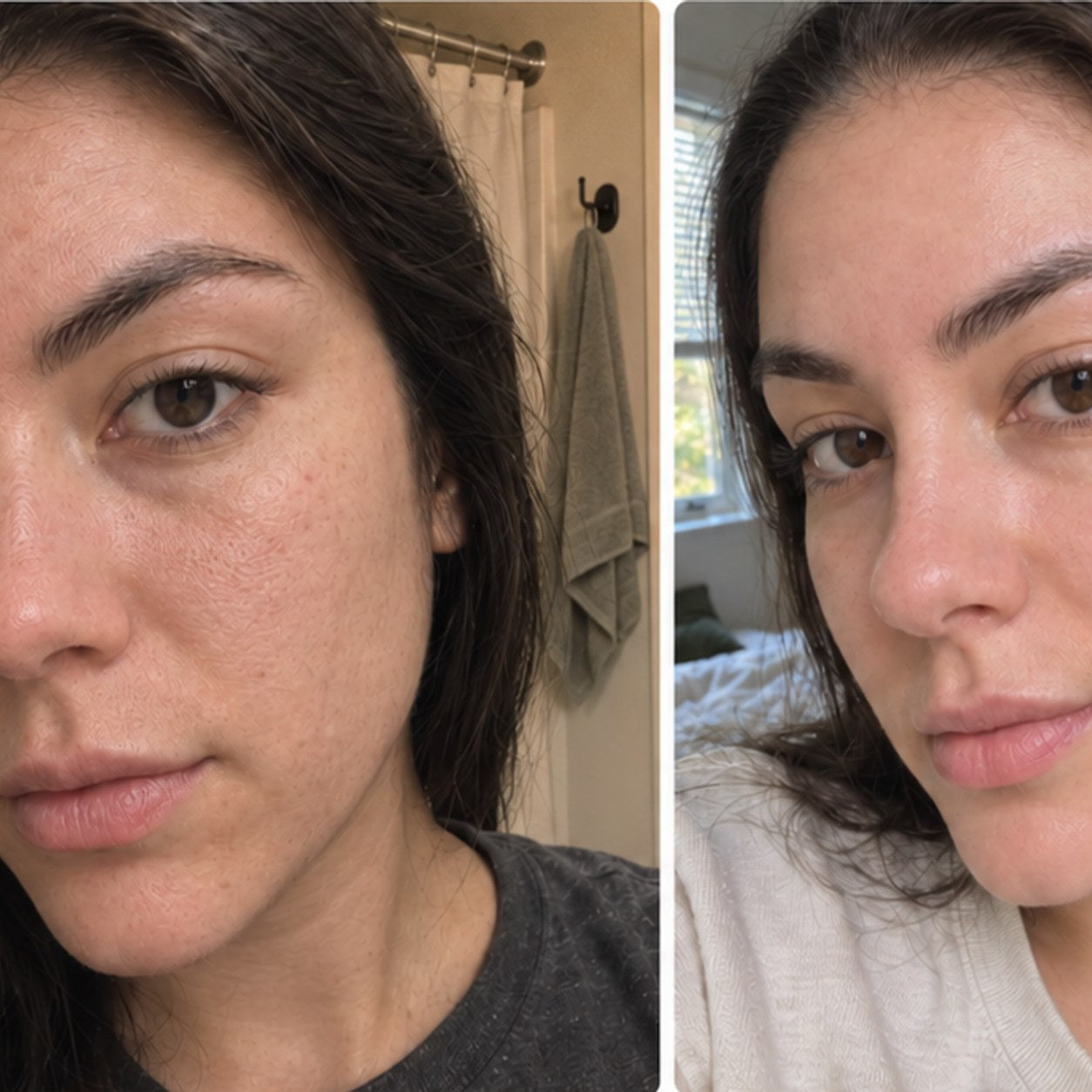 Dry skin results