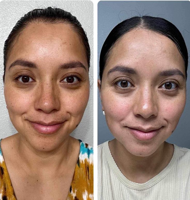 FIIPY customer result